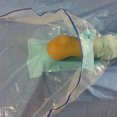 L'Arthroscopy chirurgical jetable médical de genou drapent le paquet/kit